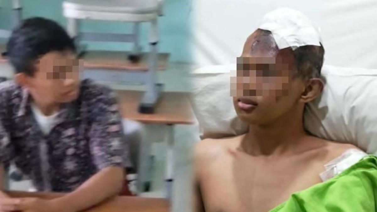 LEDAKAN DI SMAN 72 JAKARTA - Tatapan Tajam Pelaku Ledakan SMAN 72 Jakarta Dengan Kepala Terluka Parah, Tak Menyesal Bom Masjid?