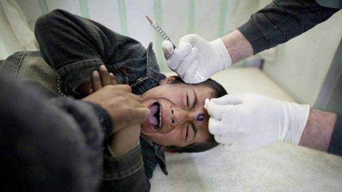 Ngeri! Tidak Hanya Menderita Akibat Perang, Warga Suriah Juga Diserang Parasit Pemakan Daging!