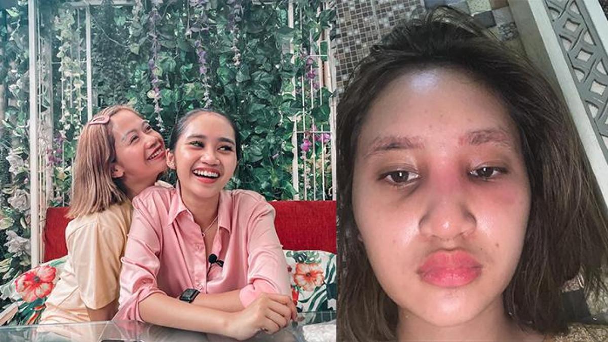 ANAK JADI KORBAN KEKERASAN - Permesta Dhyaz Ris Putri Wibowo lahir pada 27 Maret 2000 dan merupakan anak tunggal Farida Nurhan.