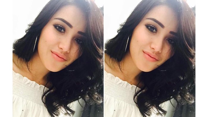 Kerap Disebut Memakai Susuk Agar Populer, Ayu Ting Ting Angkat Bicara dengan Cara Ini