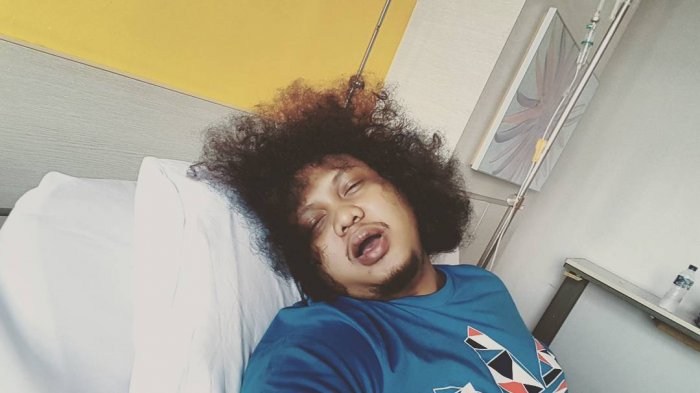 Instagram Babe Cabita - Begini Kondisi Sang Komika Setelah Jalani Operasi Amandel