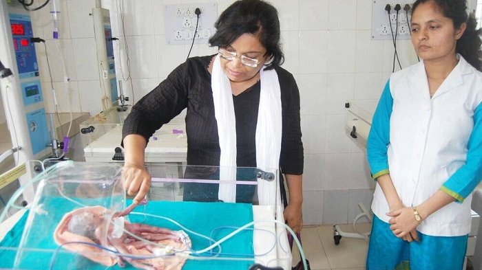 Lahir dengan Empat Tangan dan Kaki, Bayi ini Mengalami Kenyataan Pahit Setelah Dilahirkan