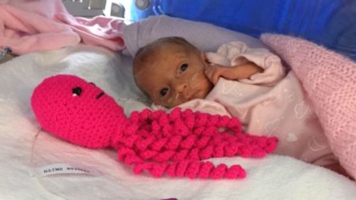 Bayi Kembar ini Kondisinya Sempat Kritis, tapi Boneka Rajut Gurita Mengubah Jalan Hidupnya
