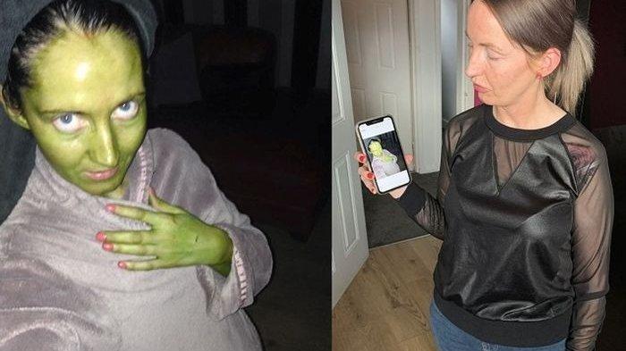 Gara-gara Krim Palsu, Kulit Wanita Ini Berubah jadi Hijau bak Penyihir, Mati-matian untuk Menggosok