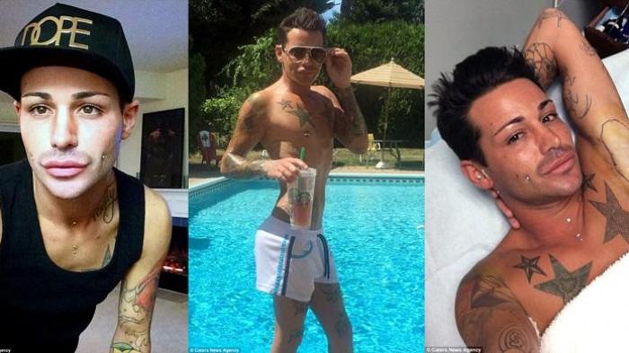 Operasi Plastik Joey Prixx - Oh God! Cowok Ini Udah 100 Kali Permak Tubuh, Doi Merasa Belum Puas