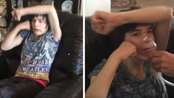 Percaya Ga Percaya! Anak Ini Autis, Saat Kejang-kejang Hanya Bisa Berhenti Jika Mengonsumsi Ganja