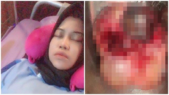 Terlalu Sering Makan Makanan Cepat Saji, Perempuan Ini Temukan Kista di Ovariumnya Membesar