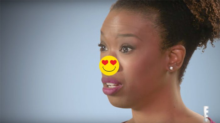 Niatnya Memancungkan Hidung, Bentuknya Malah Jadi Gini! Gadis Ini Karirnya Hancur!