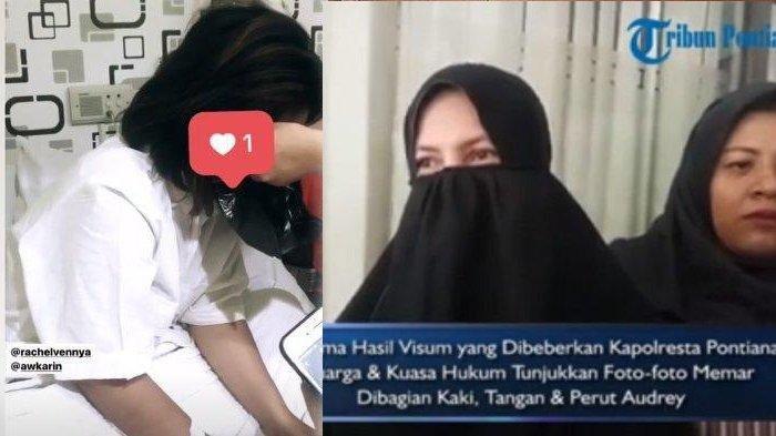 Bantah Hasil Visum, Keluarga Tunjukkan Bukti Foto Audrey Alami Luka, Kondisi Kakinya Jadi Sorotan