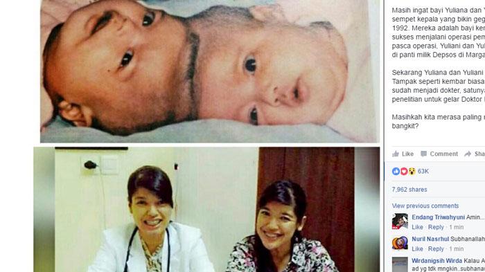 Kisah Yuliana dan Yuliani - Kenangan Itu Sering Diejek Botak di Bagian Belakang