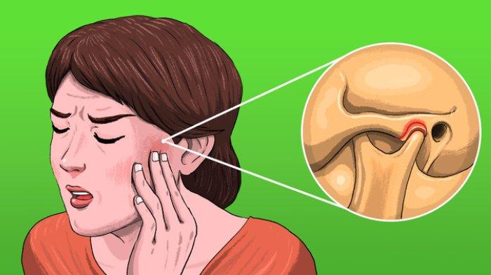 Nyeri Seperti Sakit Gigi Ternyata Bisa Disebabkan 5 Hal Ini, Tak Melulu Karena Gigi berlubang