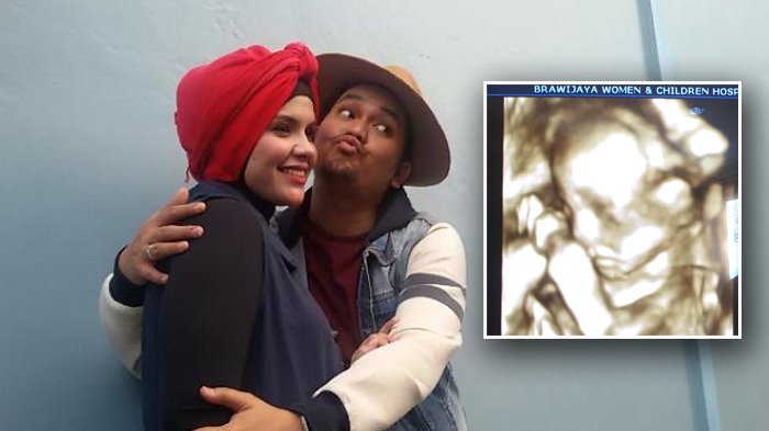 Instagram Indra Bekti - Lahir Selamat, Anak Dila Meninggal Dunia Setelah 23 Menit Bertahan