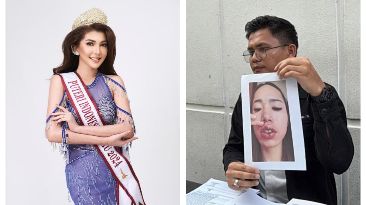 MALPRAKTIK KLINIK KECANTIKAN -