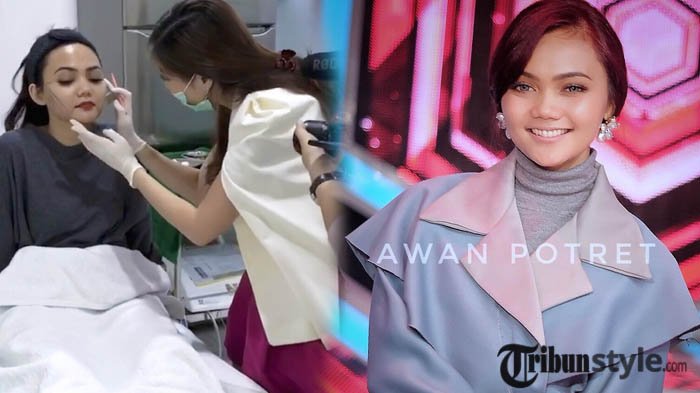 Usai Lepas Hijab, Rina Nose Kini Tanam Benang dan Sedot Lemak, Netizen: Hidungnya Nggak Sekalian?