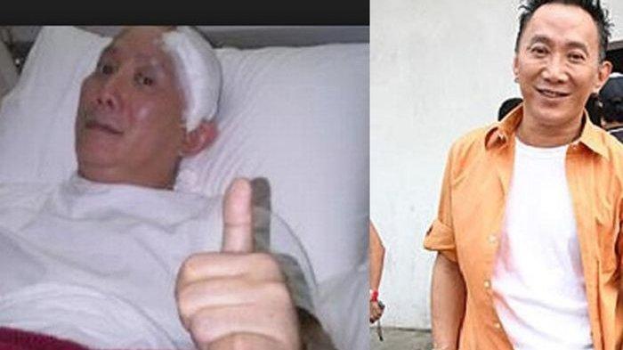 5 Gejala Infeksi Paru-paru, Penyebab Robby Tumewu Meninggal, dari Demam Hingga Batuk