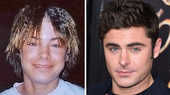 Metamorfosis Seleb Hollywood - Begini Wajah 15 Artis Sebelum dan Sesudah Tenar, Beda Banget!