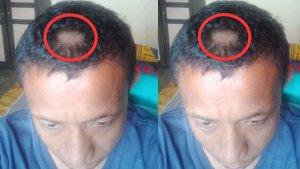 kondisi-rambut-pak-guru-ulan-hadji-yang-digunting-paksa-oleh-orang-tua-siswanya.jpg