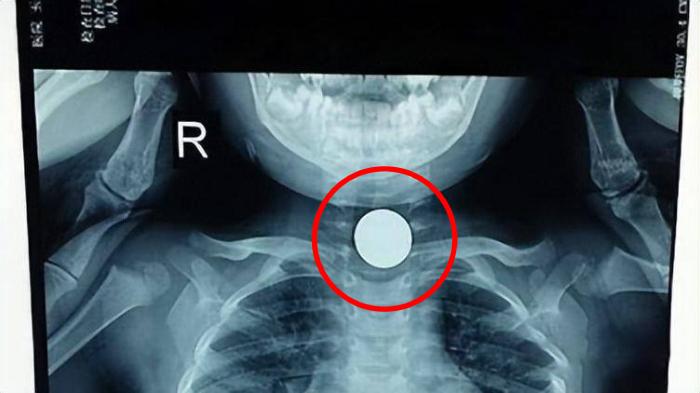 Detik-detik Balita Tewas Tersedak di Tempat Tidur, Ibu Sibuk Memasak, Ayah Disuruh Jaga Malah Tidur