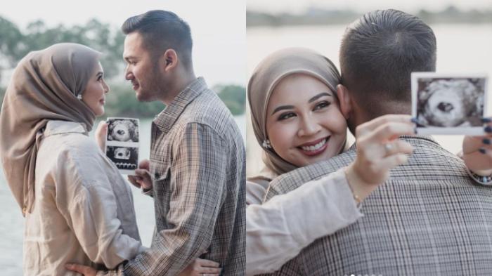 Kesha Ratuliu Umumkan Hamil Anak Ketiga, Pamer Foto USG Bareng Adhi Permana: di Luar Ekspektasi