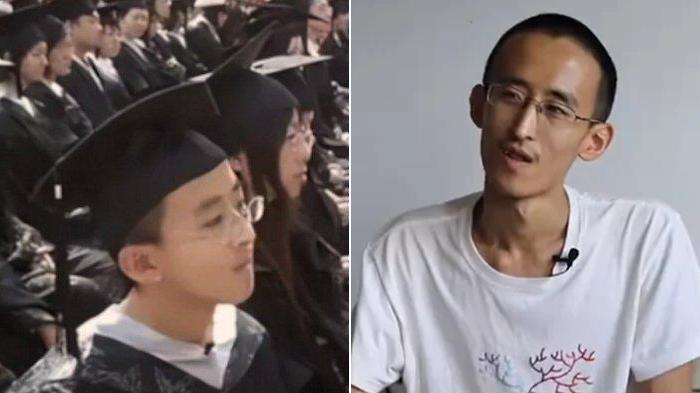 KISAH Bocah Jenius Umur 10 Tahun Sudah Kuliah, Setelah Dewasa Malah Nganggur Jadi Beban Orang Tua