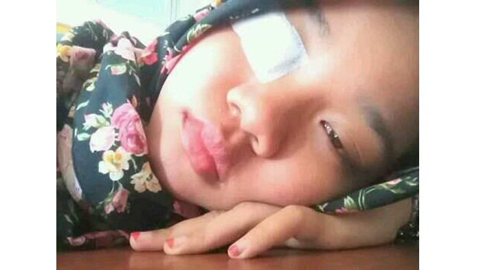 Kasihan! Wanita Ini Jadi Korban Puntung Rokok, Kisahnya Jadi Pelajaran Agar Waspada di Jalan