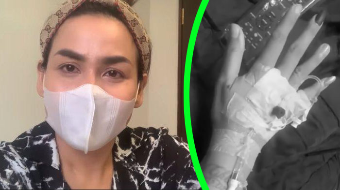 5 Fakta Melaney Ricardo Kena Covid-19 hingga Sembuh, Jantung Bermasalah hingga Habiskan Banyak Uang