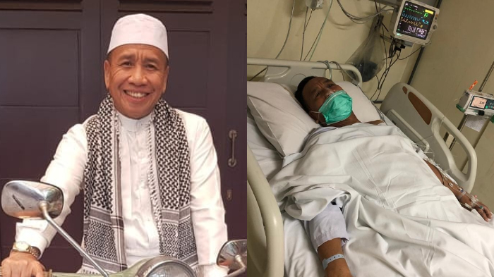 Tergolek Lemah di RS, Miing Bagito Ternyata Baru Saja Operasi, Didin Bagito Ungkap Sakit Kakaknya