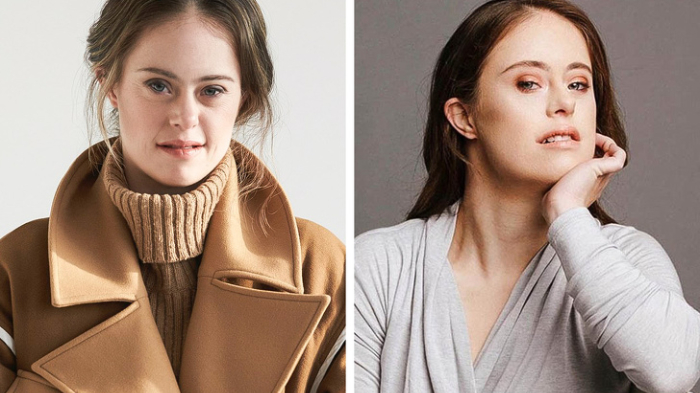 Model Cantik Ini Ternyata Pengidap Down Syndrome, Sukses Juara Olimpiade 4 Kali Bikin Takjub Dunia!