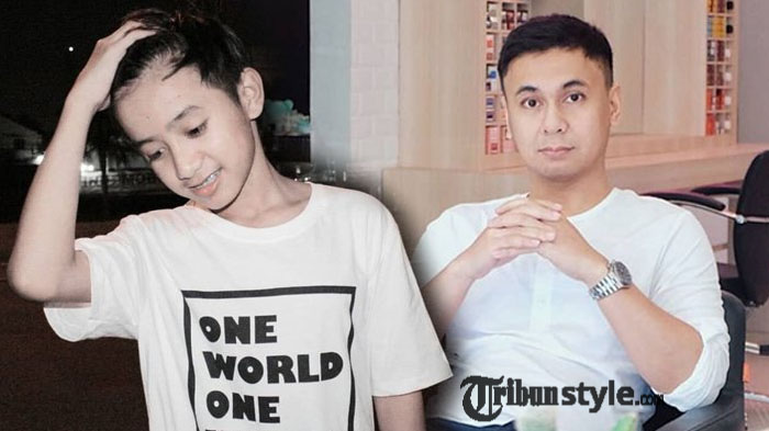 Niat Beri Dukungan, Raditya Dika Justru Dapat Perlakuan Menyedihkan dari Bowo Alpenliebe