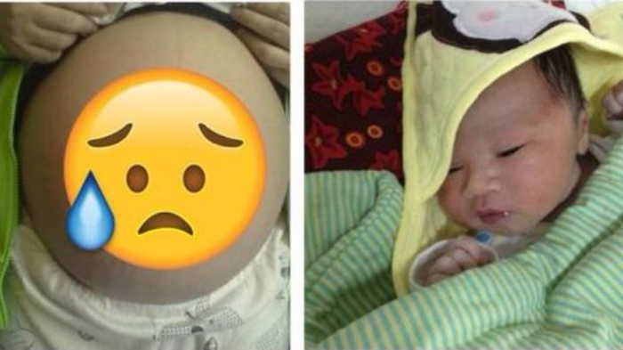 Suami Ikat Saluran Sperma 6 Bulan, Tapi Istri Malah Hamil, Penyebabnya Sungguh Tak Disangka