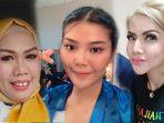 6-risiko-lakukan-sulam-lesung-pipi-seperti-barbie-kumalasari-rosa-meldianti-hingga-elly-sugigi.jpg