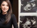 Dewi-Perssik-Beberkan-Bukti-yang-Membantah-Isu-Dirinya-Mandul.jpg