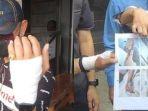 PILU-pria-di-Palembang-niat-berobat-karena-sakit-diare.jpg