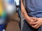 Pria-di-Cilacap-panik-pasang-cincin-di-alat-kelamin-namun-tak-bisa-melepasnya.jpg