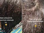 Viral-penampakan-rambut-seorang-bocah-di-Trenggalek-Jawa-Timur-penuh-dengan-kutu-2.jpg