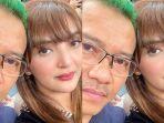 ashanty-akui-jalani-pengobatan-lagi.jpg