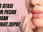 cara-ampuh-atasi-bibir-keriput.jpg