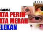 cara-ampuh-redakan-mata-merah.jpg