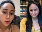 denise-chariesta-mengaku-tak-peduli-meski-foto-fotonya-yang-mengenakan-bikini-tersebar-di-tiktok.jpg