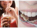 efek-meminum-minuman-manis-pada-gigi.jpg