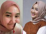 fatin-shidqia-lubis-negatif-covid-19.jpg