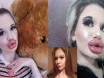 gadis-22-tahun-ketagihan-suntik-filler-demi-punya-bibir-terbesar-di-dunia.jpg