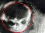ibu-ketakutan-ketika-ditunjukkan-hasil-pemindaian-ultrasonic-bayinya-seperti-tengkorak.jpg