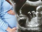 ilustrasi-hasil-usg-dan-wanita-hamil.jpg