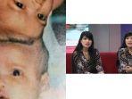 kabar-bayi-kembar-silam-yuliana-yuliani-setelah-34-tahun-sejak-operasi.jpg