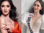 kini-tengah-disibukkan-dengan-koass-arina-rezkyana-arfa-terkejut-rumahnya-dilalap-si-jago-merah.jpg