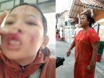 nur-wanita-yang-dihajar-ibu-rt-gara-gara-bertanya-soal-sembako.jpg