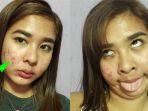 riri-flores-sering-di-bully-karena-wajahnya-yang-berjerawat_20180327_214133.jpg