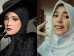 selebgram-kinclong-jadi-model-dulu-ditinggal-ortu-di-panti-asuhan-saat-usia-3-hari.jpg