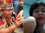 seorang-pasien-ngeluh-tangannya-tak-kunjung-sembuh-meski-diobati-ida-dayak-dokter.jpg